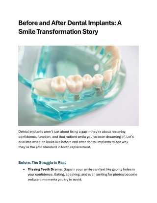 Before and After Dental Implants A Smile Transformation Stor