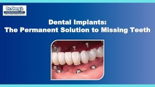 Dental Implants: The Permanent Solution to Missing Teeth