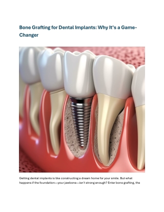 Bone Grafting for Dental Implants Why It’s a Game-Changer