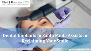 Dental Implants in Santa Paula