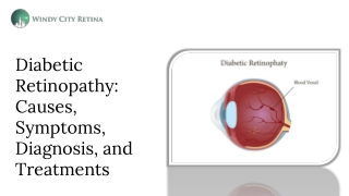 Diabetic Retinopathy: Causes, Symptoms, and Treatment Options