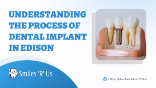 Understanding the Process of Dental Implant  in Edison