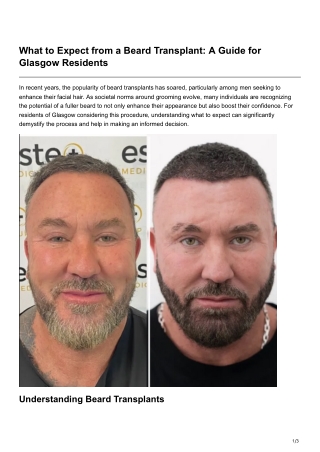 What to Expect from a Beard Transplant A Guide for Glasgow Residents