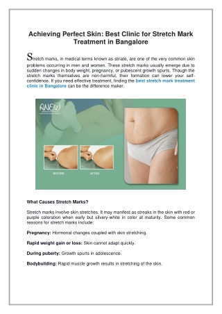 Achieving Perfect Skin, Best Clinic for Stretch Mark Treatment in Bangalore