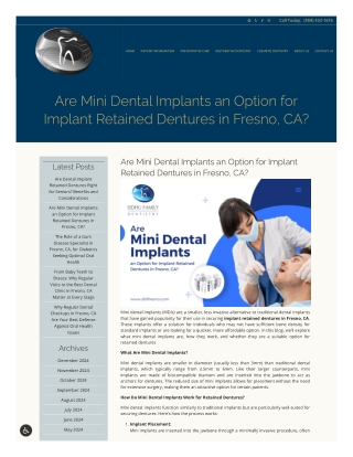 Everything You Need to Know About Mini Dental Implants