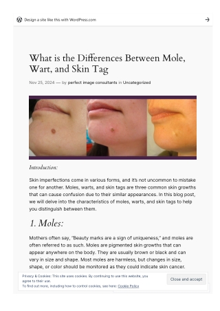 What is the Differences Between Mole, Wart, and Skin Tag