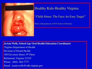 JoAnn Wells, School Age Oral Health Education Coordinator Virginia Department of Health