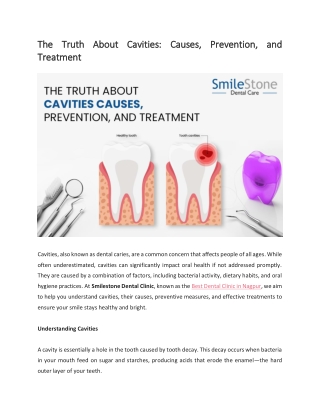 The Truth About Cavities Causes, Prevention, and Treatment