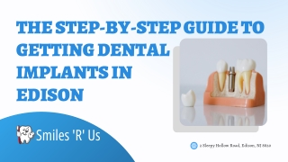 The Step-by-Step Guide to Getting Dental Implants in Edison