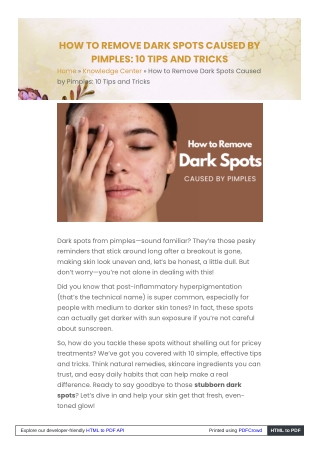 How to Remove Dark Spots Caused by Pimples 10 Tips and Tricks