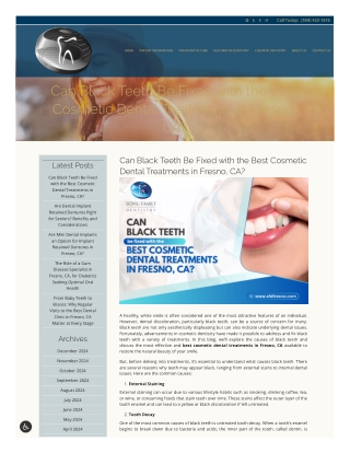 Must Visit the Best Cosmetic Dental Treatments in Fresno, CA