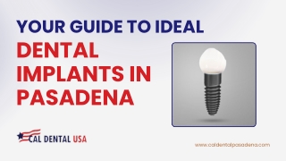 Your Guide to Ideal Dental Implants in Pasadena