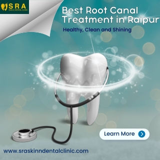 Best Root Canal Treatment in Raipur
