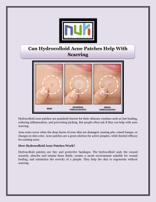 Can Hydrocolloid Acne Patches Help With Scarring