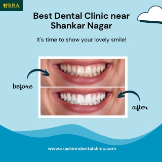 Best Dental Clinic near Shankar Nagar