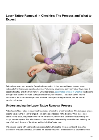 Laser Tattoo Removal in Cheshire The Process and What to Expect