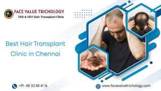 Best Hair Transplant Clinic in Chennai