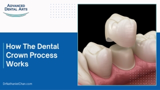 Understanding the Dental Crown Process