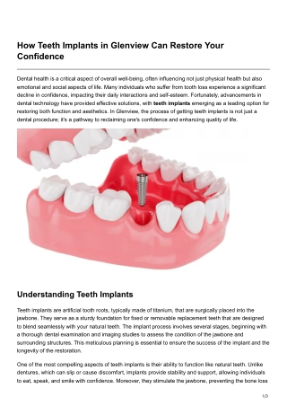 How Teeth Implants in Glenview Can Restore Your Confidence