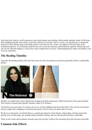 Laser Hair Removal Healing Process