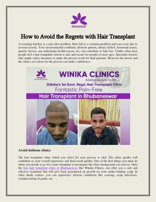 How to Avoid the Regrets with Hair Transplant