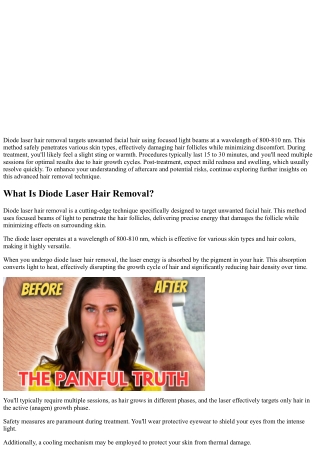 Diode Laser Hair Removal on Face