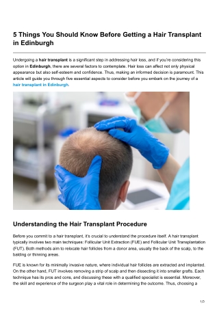 5 Things You Should Know Before Getting a Hair Transplant in Edinburgh