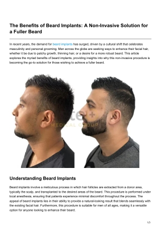 The Benefits of Beard Implants A Non-Invasive Solution for a Fuller Beard