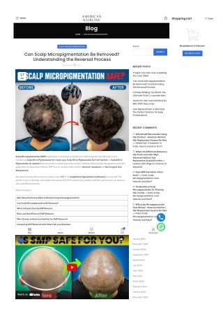 Can Scalp Micropigmentation Be Removed Understanding the Reversal Process