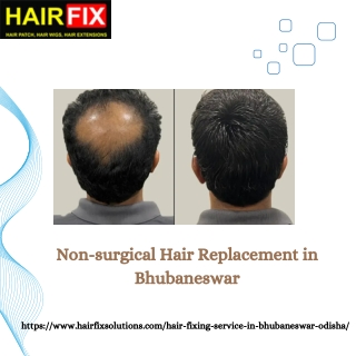 Non-surgical Hair Replacement in Bhubaneswar