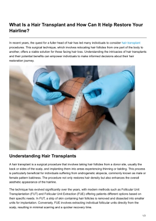 What Is a Hair Transplant and How Can It Help Restore Your Hairline