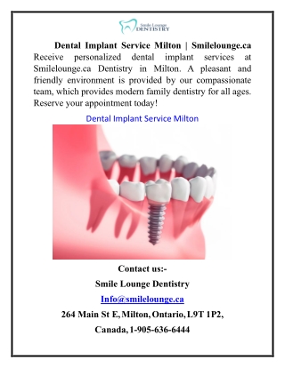 Dental Implant Service Milton