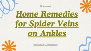 Home remedies for spider veins