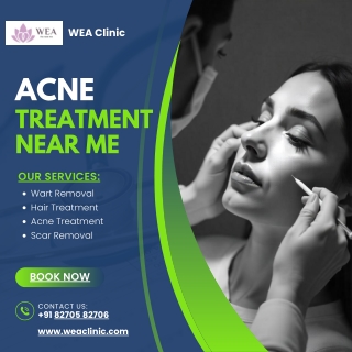 Clear Your Skin with the Best Acne Treatment Near Me at WEA Clinic