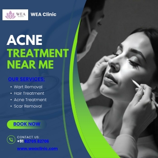 The Best Acne Treatment Near Me – WEA Clinic Has You Covered