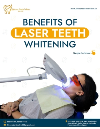 Benefits of Laser Teeth Whitening - Life Care Dental Clinic