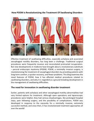 How POEM Is Revolutionizing The Treatment Of Swallowing Disorders