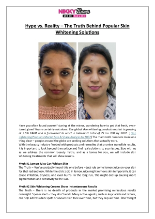 Truth Behind Popular Skin Whitening Solutions