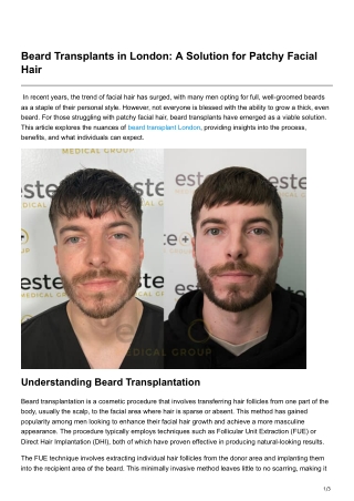 Beard Transplants in London A Solution for Patchy Facial Hair