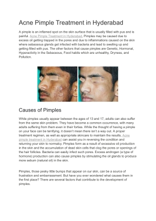 Acne Pimple Treatment in Hyderabad | Neoskin Clinic