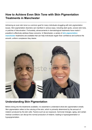 How to Achieve Even Skin Tone with Skin Pigmentation Treatments in Manchester