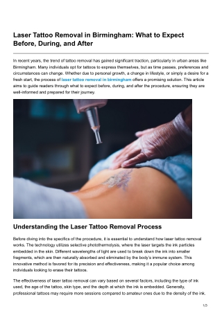 Laser Tattoo Removal in Birmingham What to Expect Before During and After