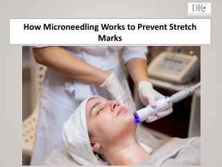 How Microneedling Works to Prevent Stretch Marks