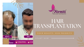 Hair Transplantation