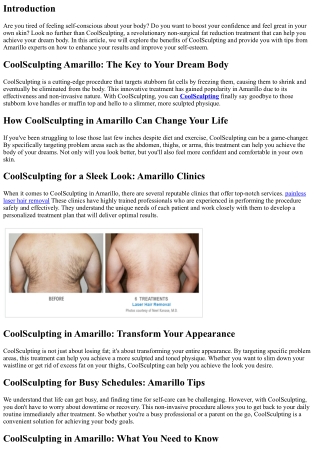 Boost Your Confidence with CoolSculpting: Tips from Amarillo Experts