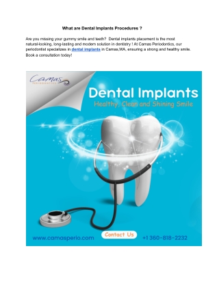 What are Dental Implants Procedures ?