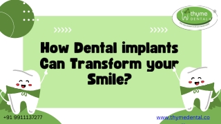 How Dental implants Can Transform your Smile