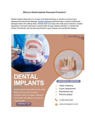 What are Dental Implants Placement Procedure ?