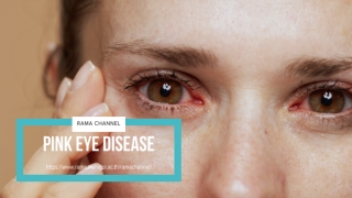 Pink Eye Disease | RAMA CHANNEL