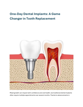 One-Day Dental Implants A Game Changer in Tooth Replacement